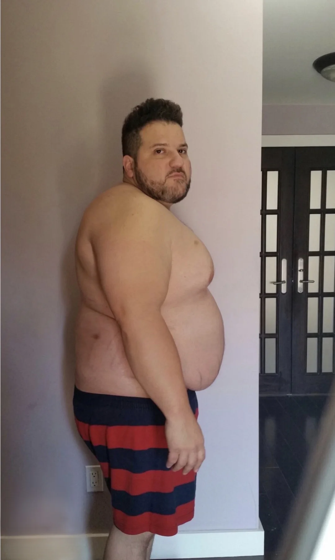 Anthony Lolli before the transformation